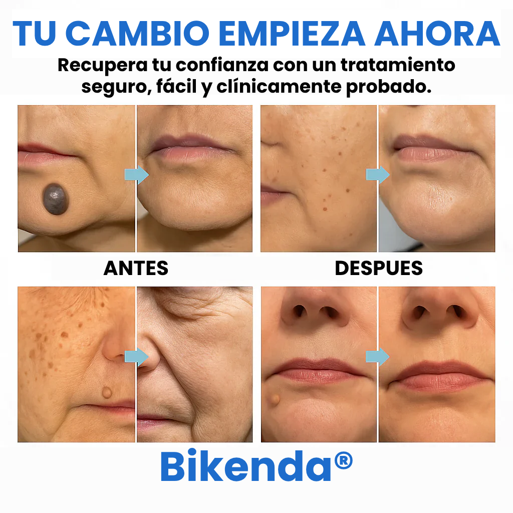 Bikenda® Lápiz Láser con tecnología CO₂